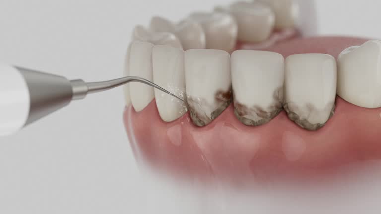 Reliable Tooth Extraction contractor in Loretto, TN by Smile Center Dentistry
